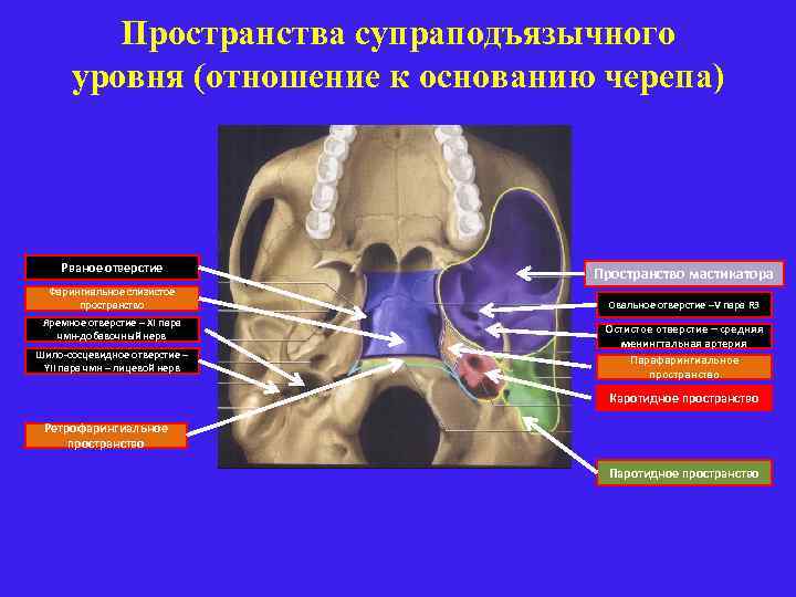 Пространства супраподъязычного уровня (отношение к основанию черепа) Рваное отверстие Фарингиальное слизистое пространство Яремное отверстие