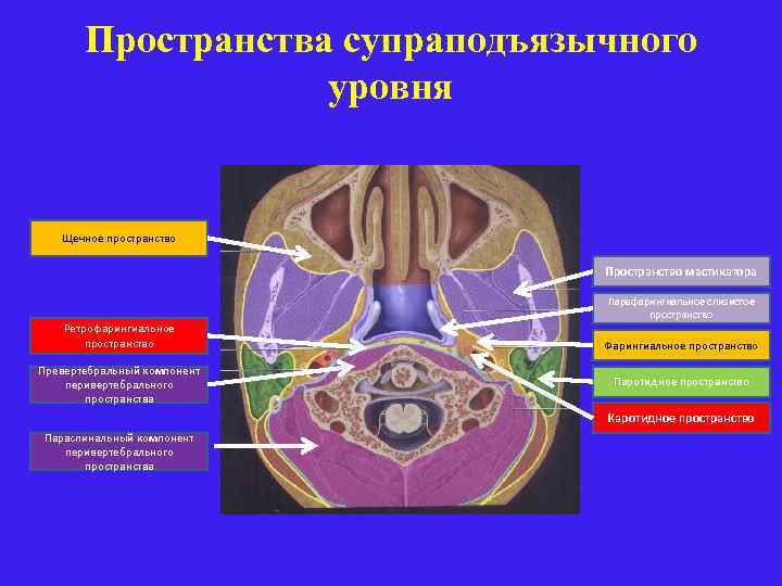 Пространства супраподъязычного уровня Щечное пространство Пространство мастикатора Ретрофарингиальное пространство Превертебральный компонент перивертебрального пространства Парафарингиальное