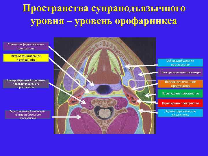 Пространства супраподъязычного уровня – уровень орофаринкса Слизистое фарингиальное пространство Ретрофарингиальное пространство Субмандибулярное пространство Пространство