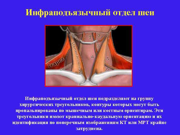 Инфраподъязычный отдел шеи подразделяют на группу хирургических треугольников, контуры которых могут быть пропальпированы по