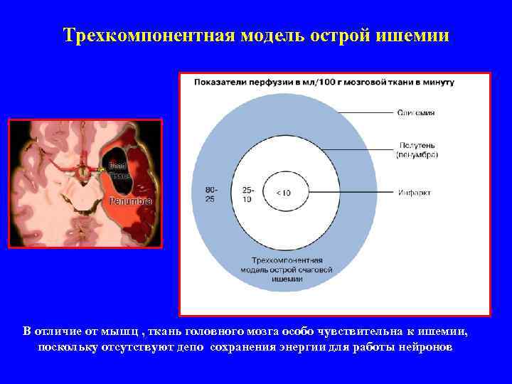 Трехкомпонентная модель острой ишемии В отличие от мышц , ткань головного мозга особо чувствительна