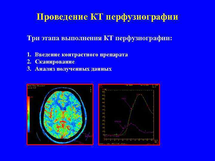 Проведение КТ перфузиографии Три этапа выполнения КТ перфузиографии: 1. Введение контрастного препарата 2. Сканирование