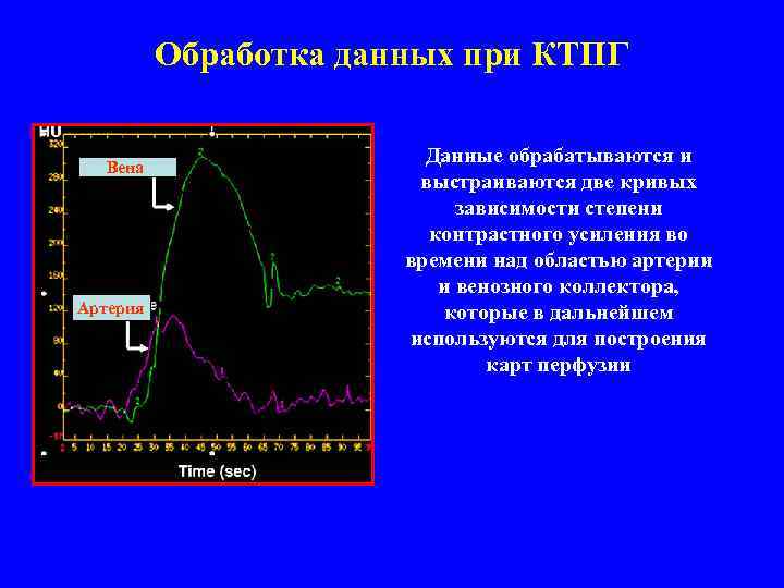 Обработка данных при КТПГ Вена Артерия Данные обрабатываются и выстраиваются две кривых зависимости степени