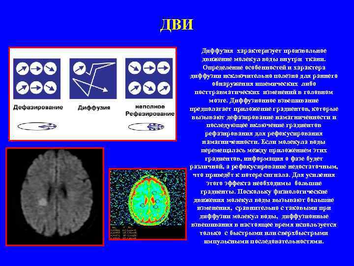 ДВИ Диффузия характеризует произвольное движение молекул воды внутри ткани. Определение особенностей и характера диффузии