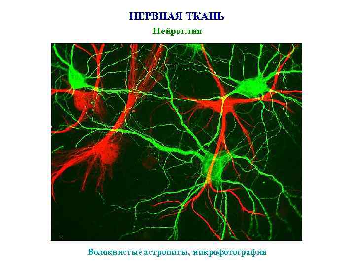 НЕРВНАЯ ТКАНЬ Нейроглия Волокнистые астроциты, микрофотография 