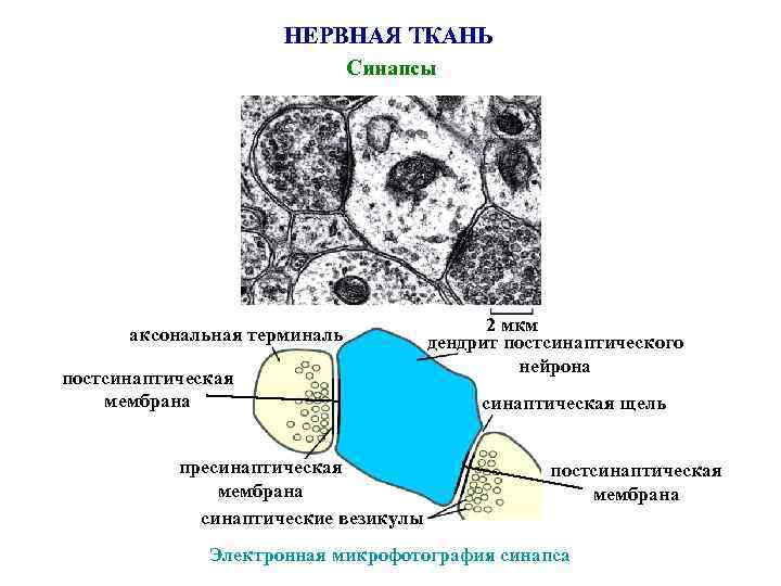 НЕРВНАЯ ТКАНЬ Синапсы аксональная терминаль постсинаптическая мембрана пресинаптическая мембрана синаптические везикулы 2 мкм дендрит