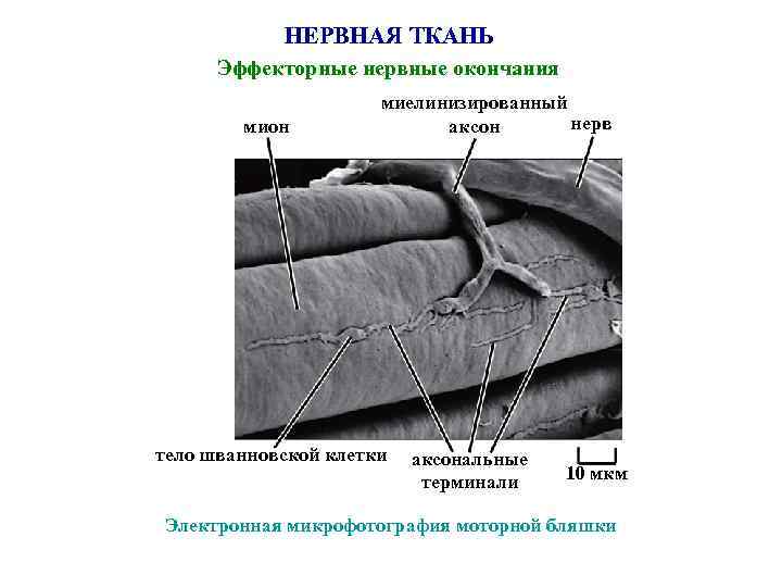 НЕРВНАЯ ТКАНЬ Эффекторные нервные окончания мион миелинизированный нерв аксон тело шванновской клетки аксональные терминали
