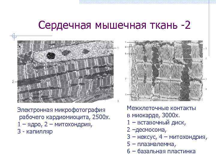 Сердечная мышечная ткань -2 Электронная микрофотография рабочего кардиомиоцита, 2500 х. 1 – ядро, 2