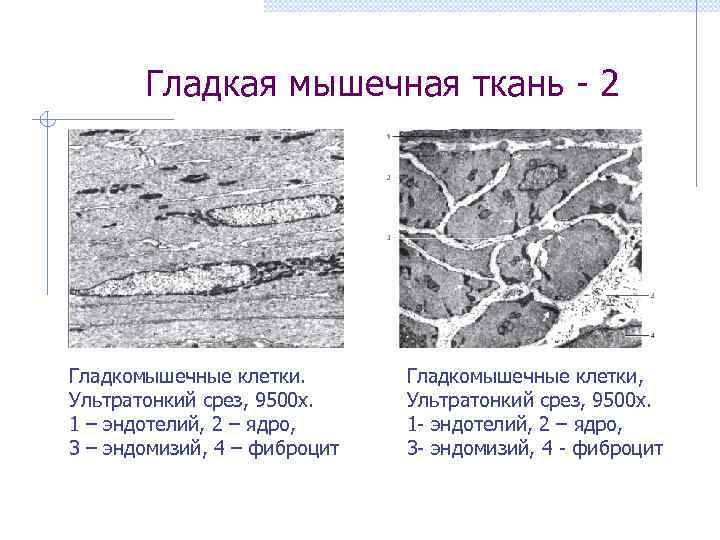 Гладкая мышечная ткань - 2 Гладкомышечные клетки. Ультратонкий срез, 9500 х. 1 – эндотелий,