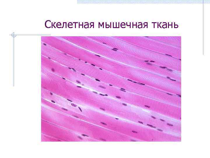 Скелетная мышечная ткань 