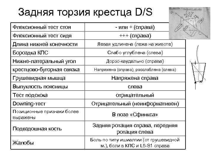 Задняя торзия крестца D/S Флексионный тест стоя или + (справа) Флексионный тест сидя +++