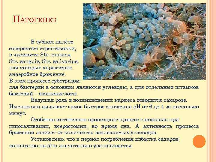 ПАТОГЕНЕЗ В зубном налёте содержатся стрептококки, в частности Str. mutans, Str. sanguis, Str. salivarius,