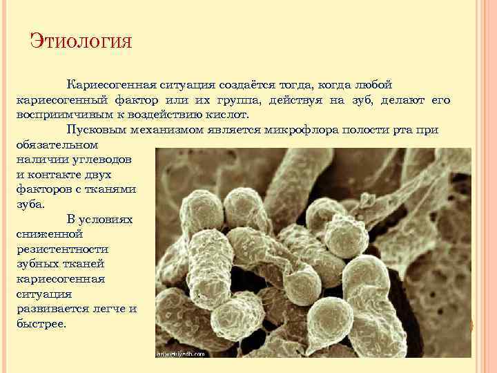 ЭТИОЛОГИЯ Кариесогенная ситуация создаётся тогда, когда любой кариесогенный фактор или их группа, действуя на
