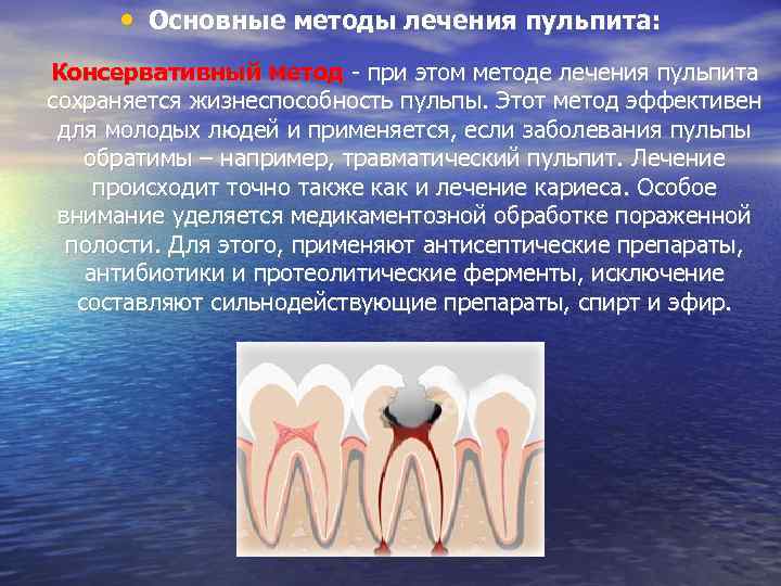  • Основные методы лечения пульпита: Консервативный метод - при этом методе лечения пульпита
