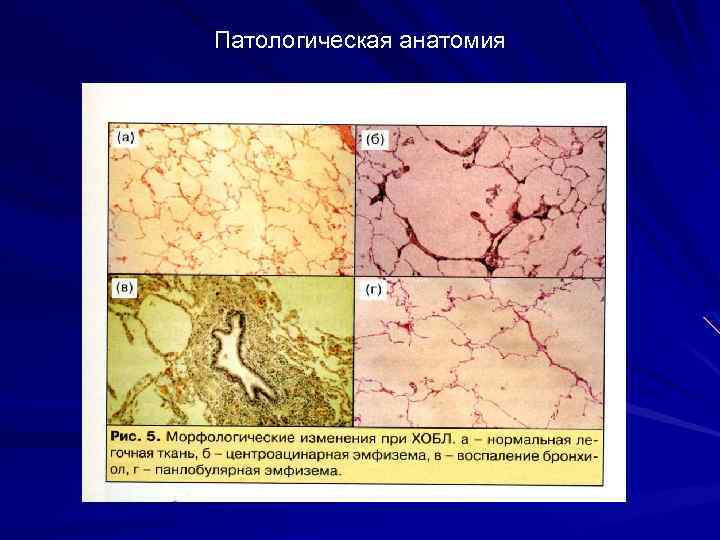 Патологическая анатомия 