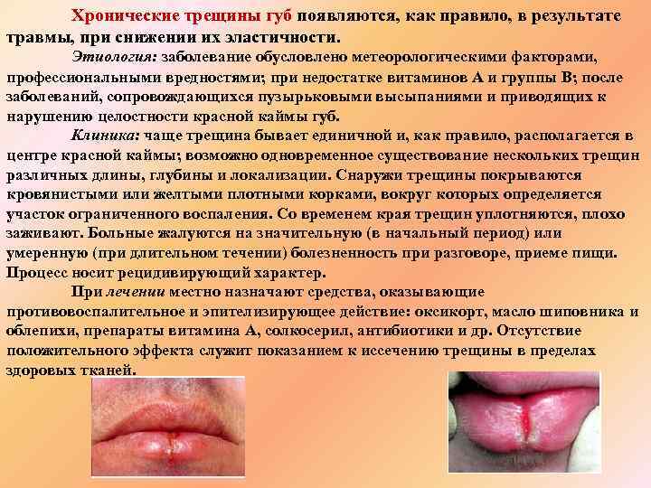 Хронические трещины губ появляются, как правило, в результате травмы, при снижении их эластичности. Этиология:
