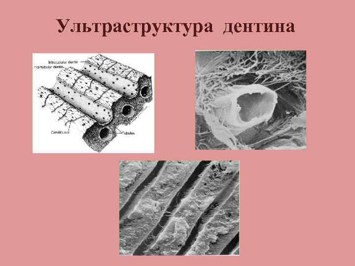 Ультраструктура дентина 