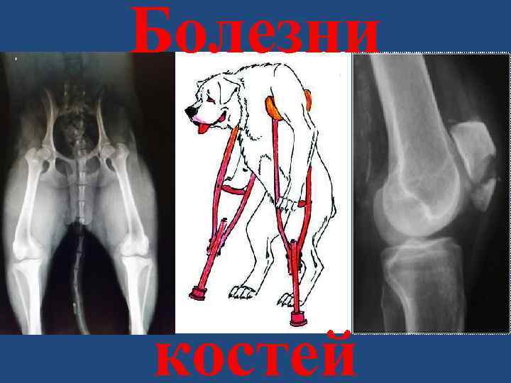 Болезни костей 