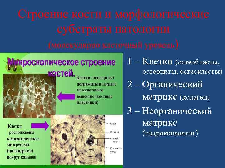 Строение кости и морфологические субстраты патологии (молекулярно клеточный уровень) 1 – Клетки (остеобласты, остеоциты,