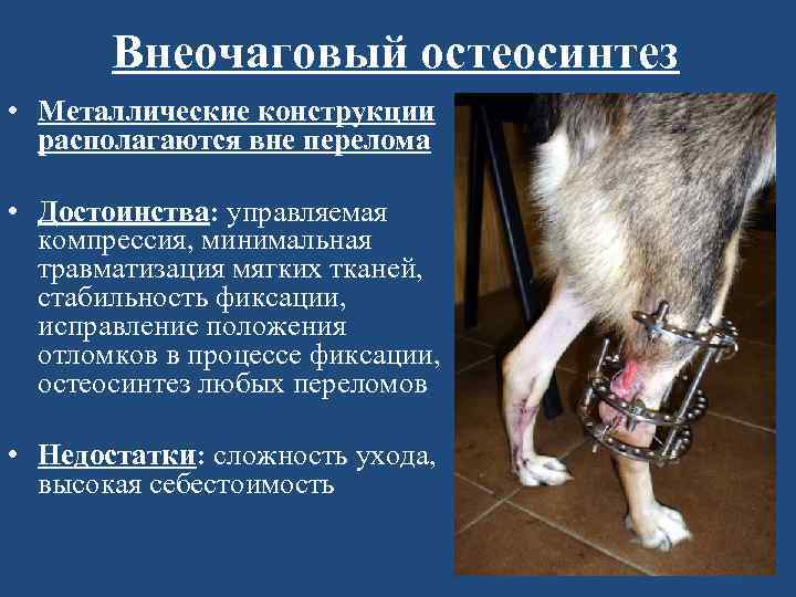 Внеочаговый остеосинтез • Металлические конструкции располагаются вне перелома • Достоинства: управляемая компрессия, минимальная травматизация