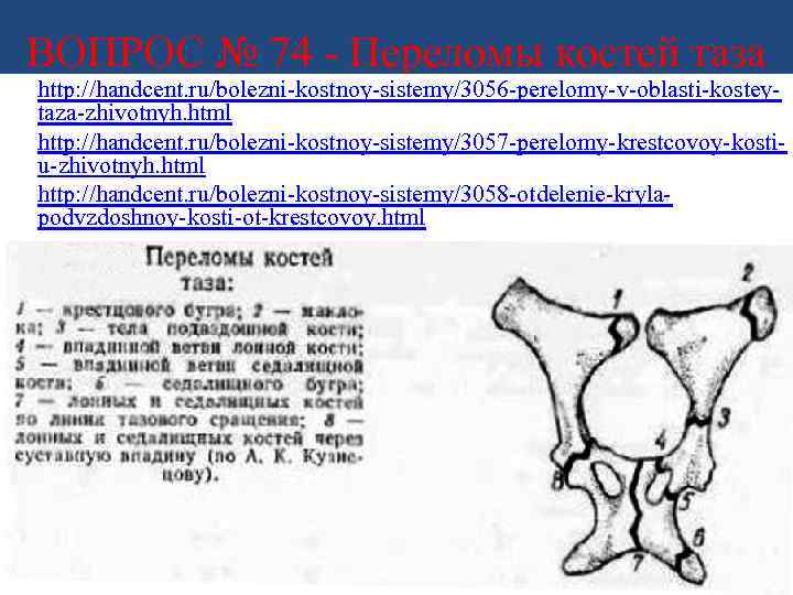 ВОПРОС № 74 - Переломы костей таза • http: //handcent. ru/bolezni-kostnoy-sistemy/3056 -perelomy-v-oblasti-kosteytaza-zhivotnyh. html •