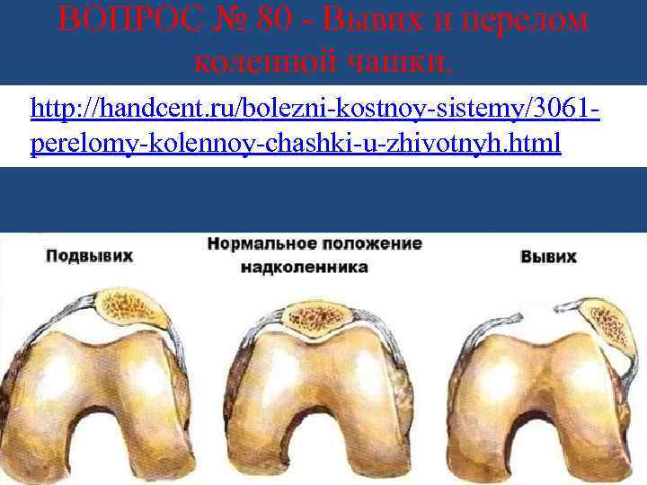 ВОПРОС № 80 - Вывих и перелом коленной чашки. • http: //handcent. ru/bolezni-kostnoy-sistemy/3061 perelomy-kolennoy-chashki-u-zhivotnyh.