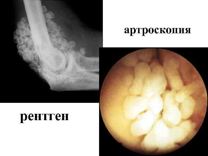 артроскопия рентген 