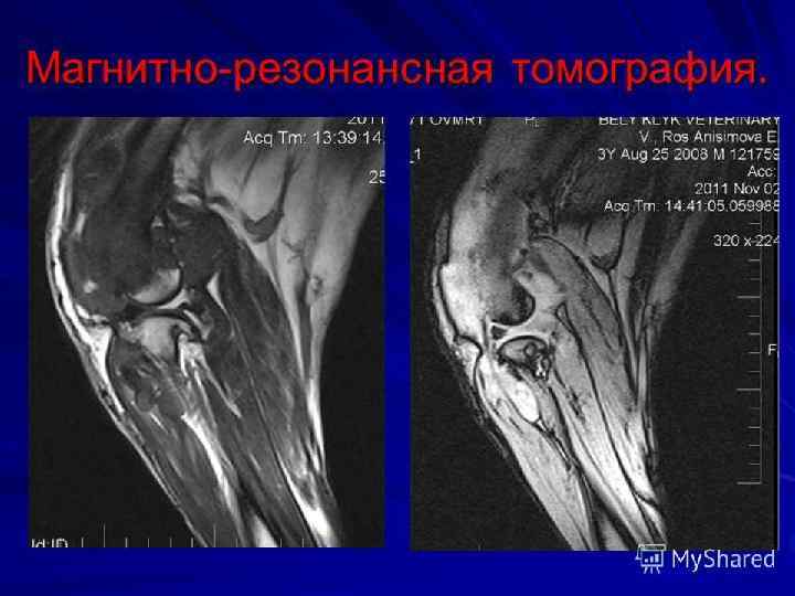 Стол при болезни суставов