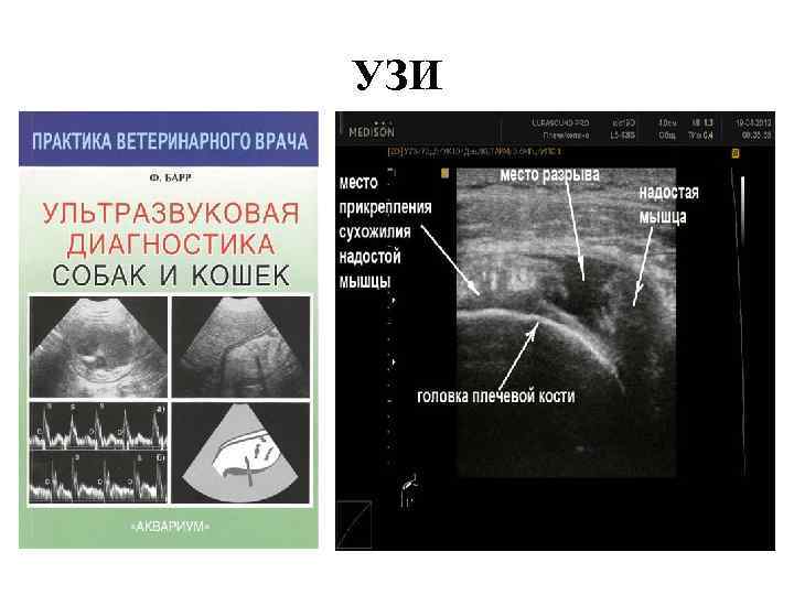 УЗИ 