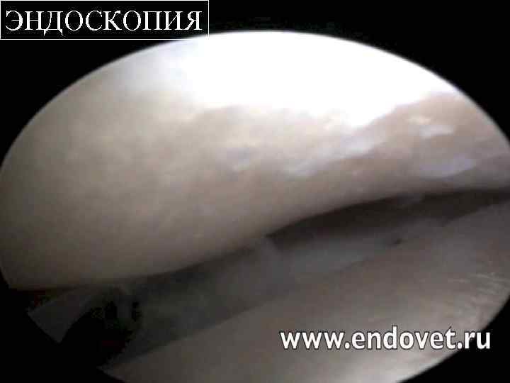 ЭНДОСКОПИЯ 