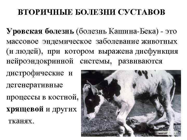 ВТОРИЧНЫЕ БОЛЕЗНИ СУСТАВОВ Уровская болезнь (болезнь Кашина-Бека) - это массовое эндемическое заболевание животных (и