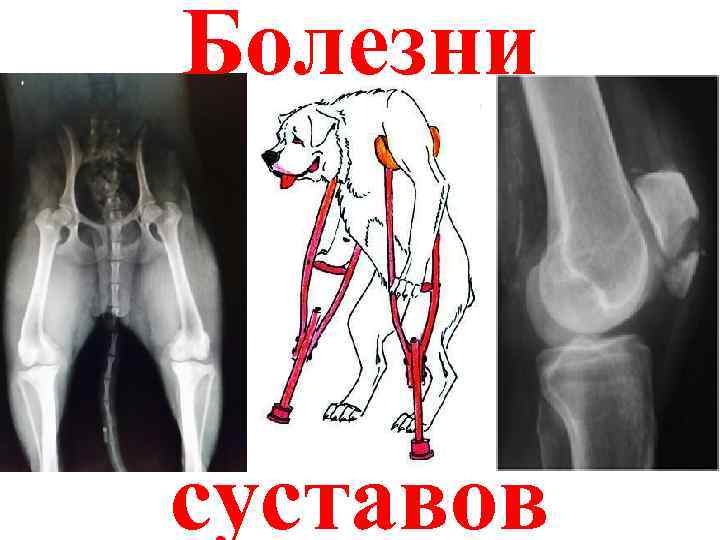 Стол при болезни суставов