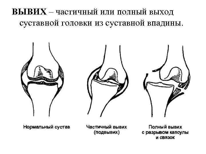 Стол при болезни суставов