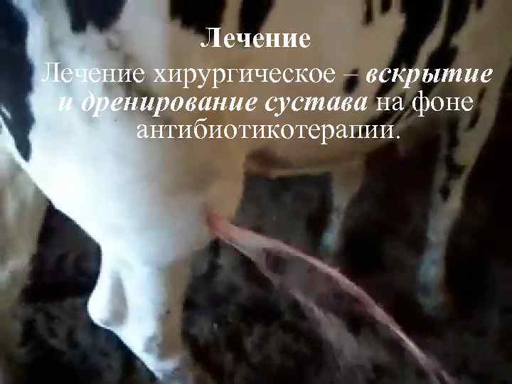 Лечение хирургическое – вскрытие и дренирование сустава на фоне антибиотикотерапии. 