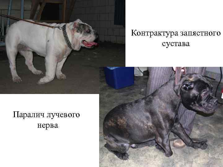 Контрактура запястного сустава Паралич лучевого нерва 