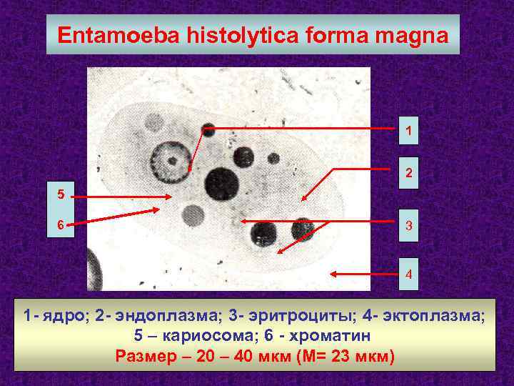 Entamoeba histolytica forma magna 1 2 5 6 3 4 1 - ядро; 2