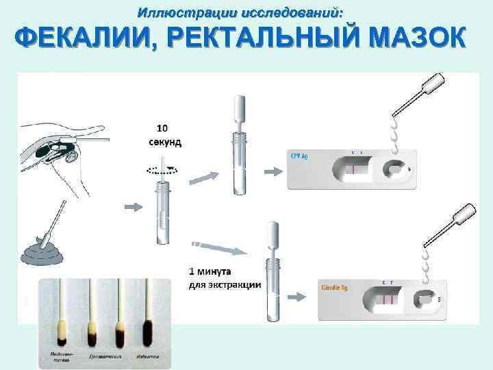 Иллюстрации исследований: ФЕКАЛИИ, РЕКТАЛЬНЫЙ МАЗОК 