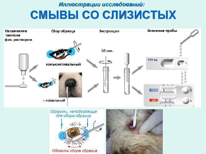 Иллюстрации исследований: СМЫВЫ СО СЛИЗИСТЫХ 