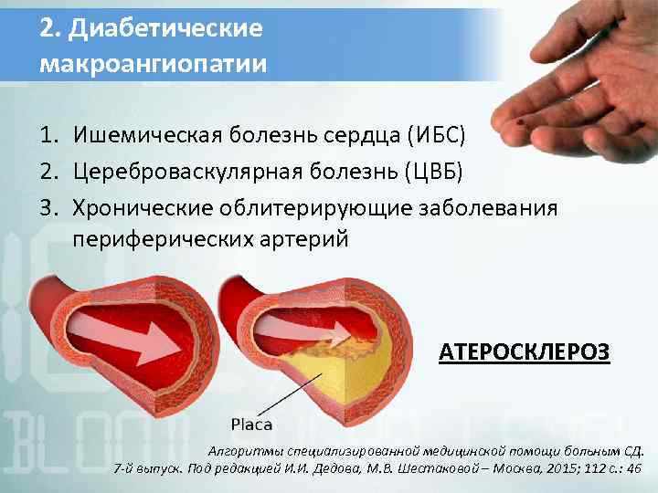 Диабетическая ангиопатия симптомы