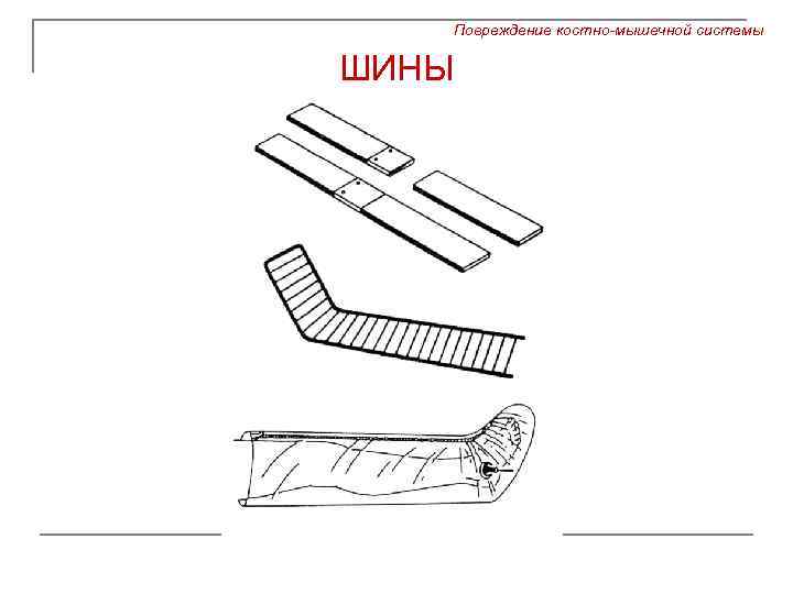 Повреждение костно-мышечной системы ШИНЫ 
