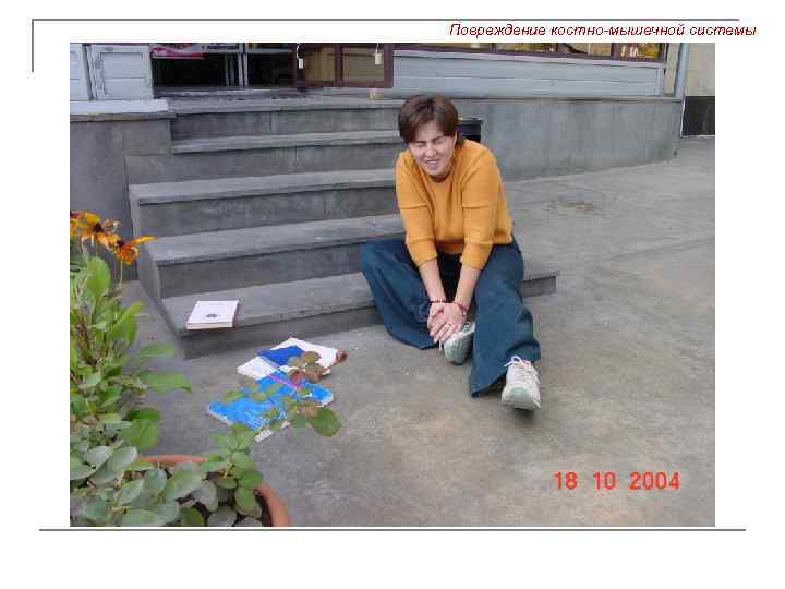 Повреждение костно-мышечной системы 