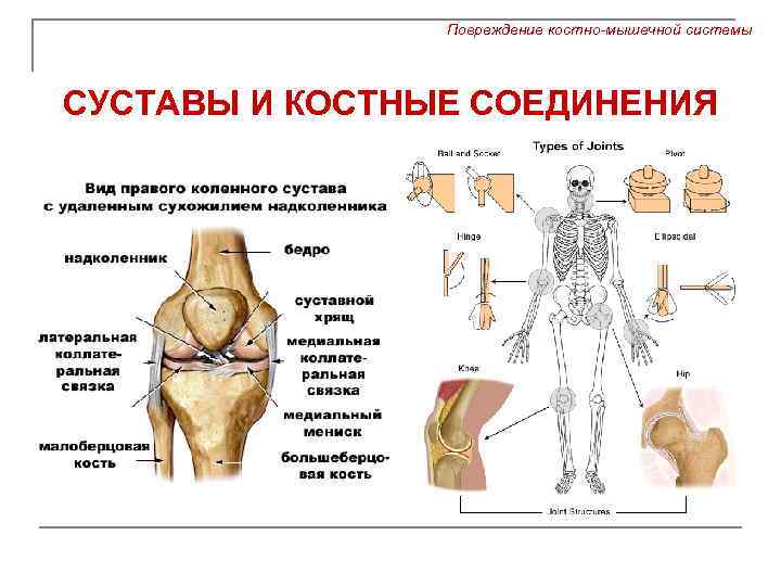 Повреждение костно-мышечной системы СУСТАВЫ И КОСТНЫЕ СОЕДИНЕНИЯ 