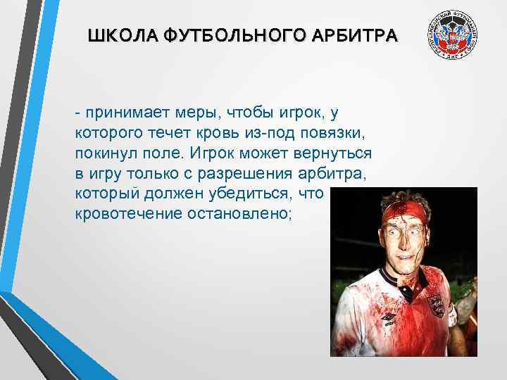 ШКОЛА ФУТБОЛЬНОГО АРБИТРА - принимает меры, чтобы игрок, у которого течет кровь из-под повязки,