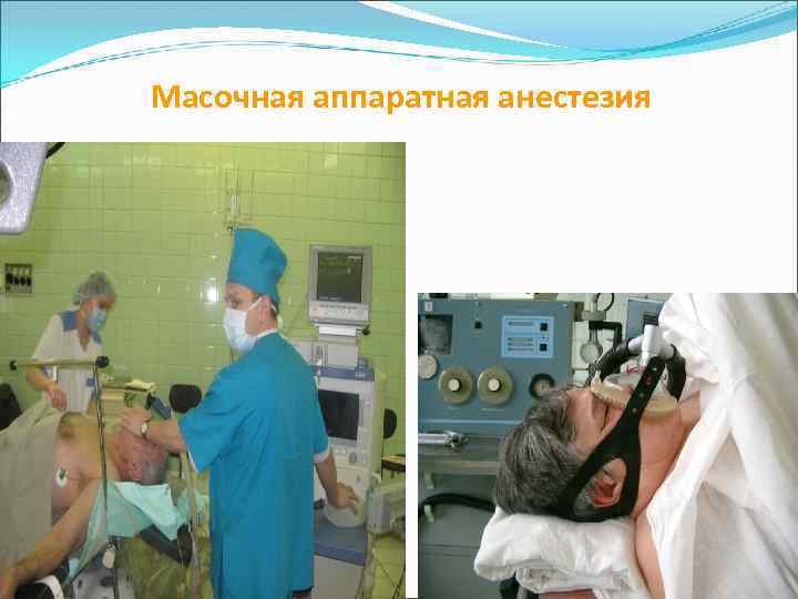 Масочная аппаратная анестезия 