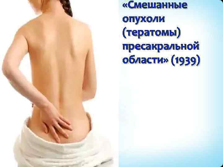  «Смешанные опухоли (тератомы) пресакральной области» (1939) 