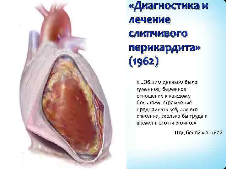  «Диагностика и лечение слипчивого перикардита» (1962) «…Общим девизом было гуманное, бережное отношение к