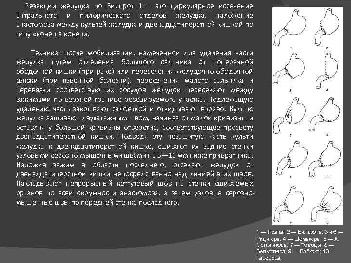 Резекции желудка по Бильрот 1 – это циркулярное иссечение антрального и пилорического отделов желудка,