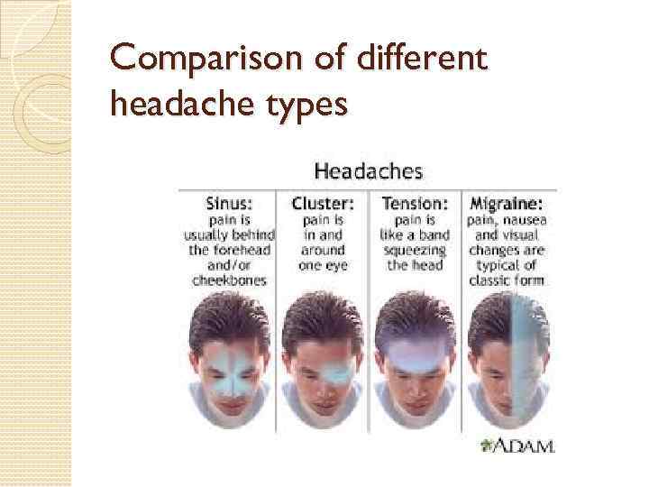 Comparison of different headache types 