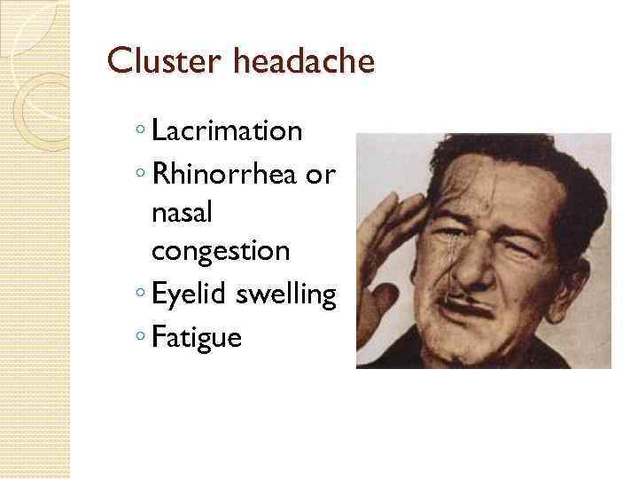 Cluster headache ◦ Lacrimation ◦ Rhinorrhea or nasal congestion ◦ Eyelid swelling ◦ Fatigue