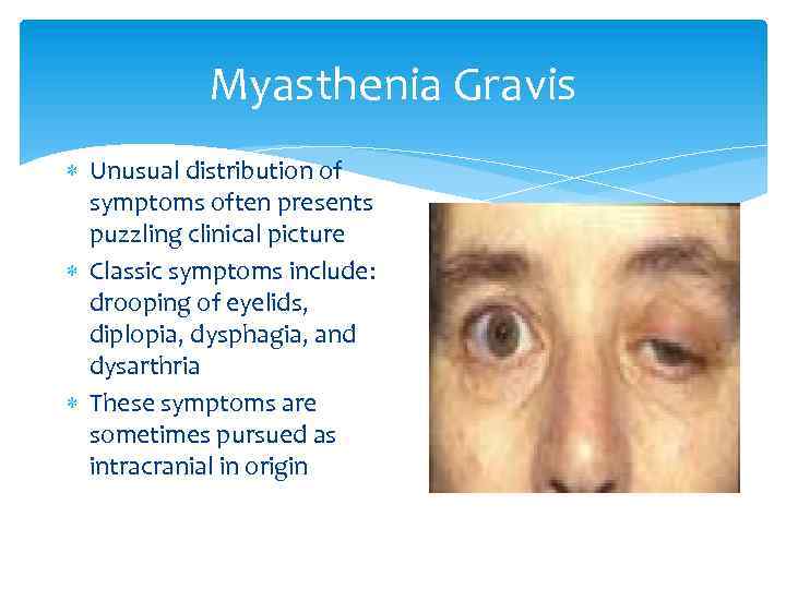 Myasthenia Gravis Unusual distribution of symptoms often presents puzzling clinical picture Classic symptoms include: